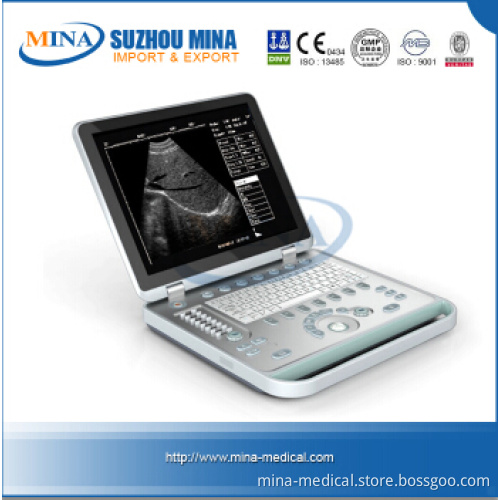 Economical Laptop B Ultrasound Scanner (ultrasound machine for pregnancy) (MINA-SS7)